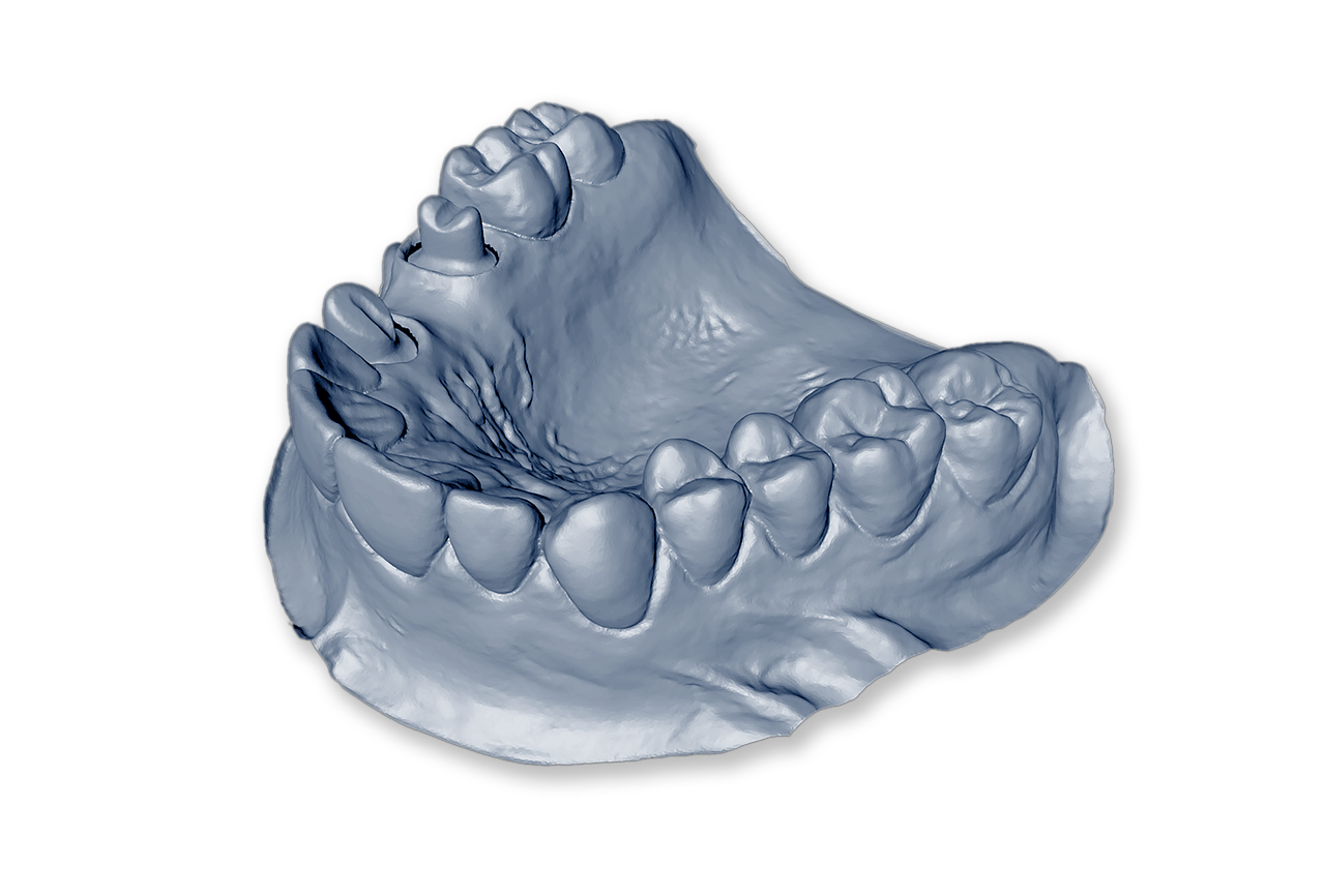 isolated, dental model, mandible